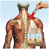 “Hi-tech” Τεχνολογία Laser στη Θεραπευτική Ιατρική
